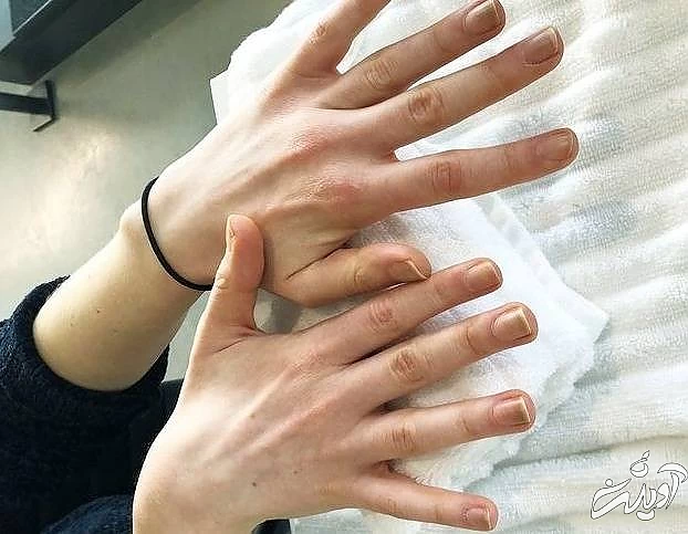 پاک کردن ژل از ناخن بررسی ناخن ها